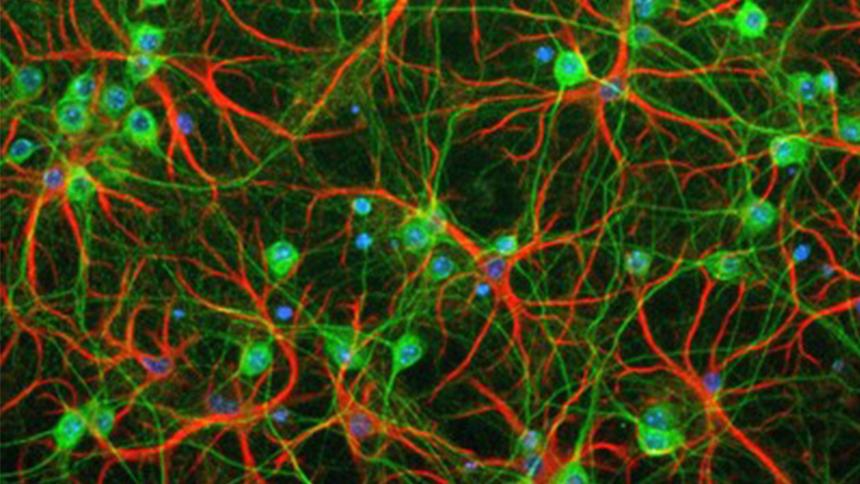 Microscope image of protein aggregation