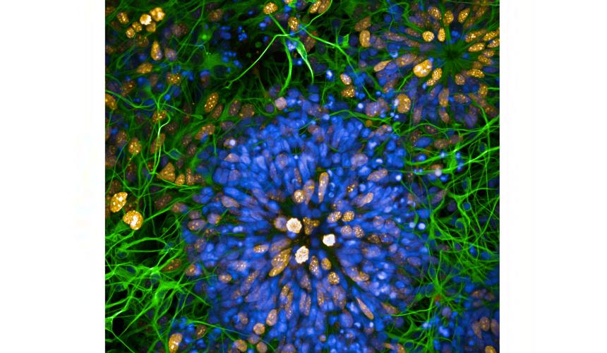 A black square image with a ring of vibrant blue petal shapes with bright green and yellow around it