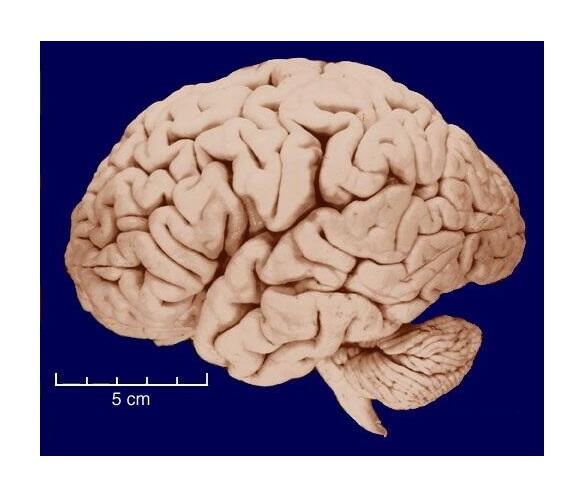 A scan of a human brain